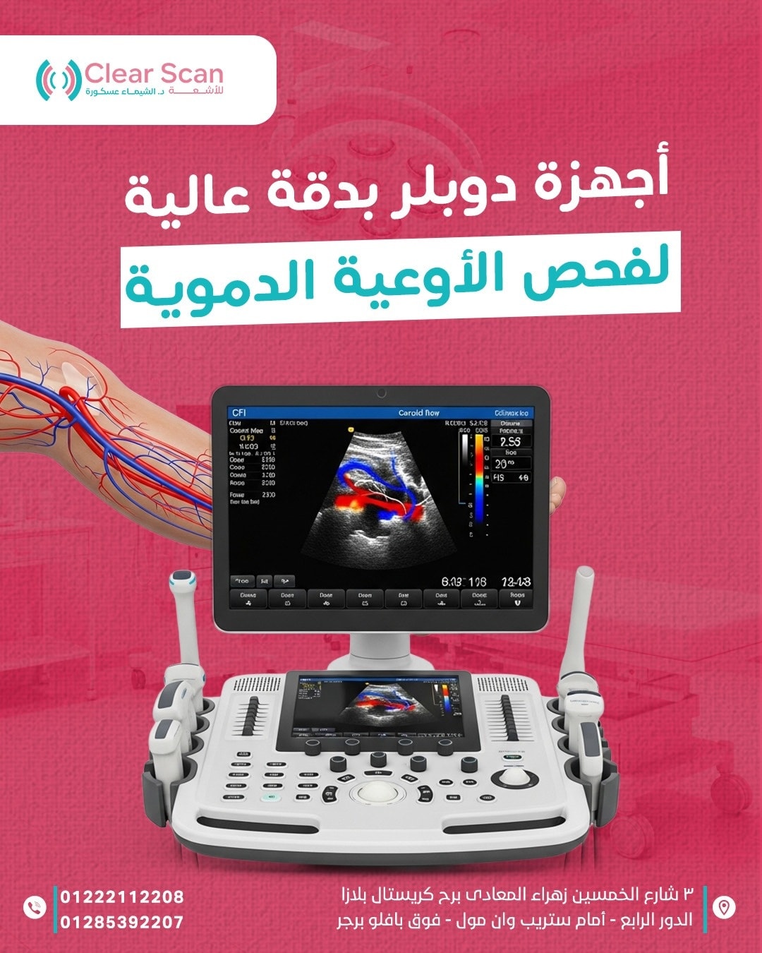 خدمة الدوبلر
